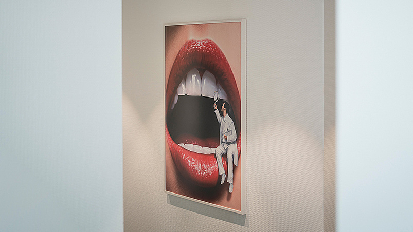 Karies-Diagnose-Laser